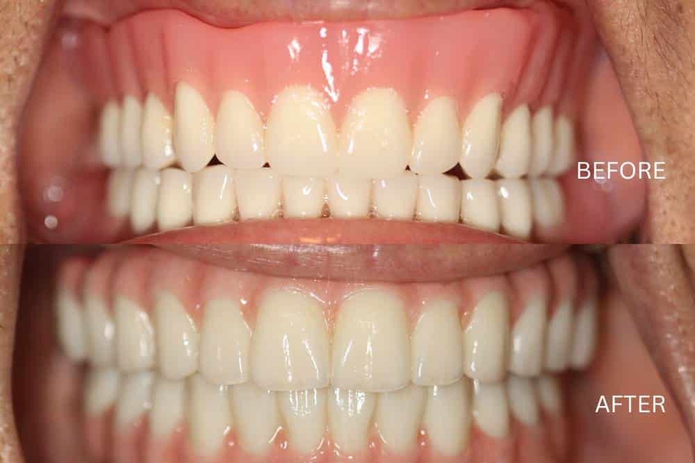 Dr. Jennifer Wallace. Palmetto Smiles of Beaufort. TMD, TMJ, Clear Aligners (SureSmile + Invisalign), Dental Implants, Sleep Apnea, Childrens Dentistry, Cosmetic Dentistry, Restorative Dentistry, General, Cosmetic, Restorative, Emergency Dentistry. Dentist in Beaufort, SC 29907